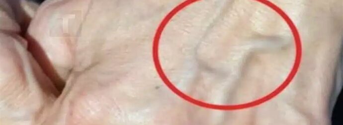 Αν έχετε ορατές φλέβες σημαίνει ότι είστε…