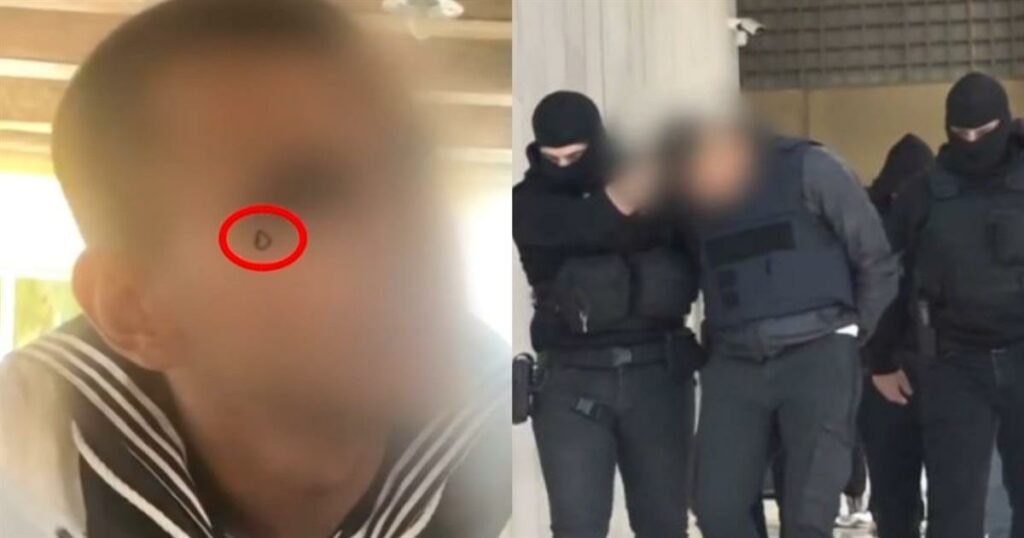 Άγιος Δημήτριος: Το σκοτεινό νόημα πίσω από το τατουάζ «δάκρυ» του 20χρονου – Τι σημαίνει στη «γλώσσα» του υποκόσμου