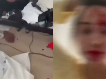 Σοκάρει γνωστό μοντέλο: Στυλίστας την χτύπησε άγρια σε ξενοδοχείο στις Κάννες – Ανατριχιαστικά βίντεο
