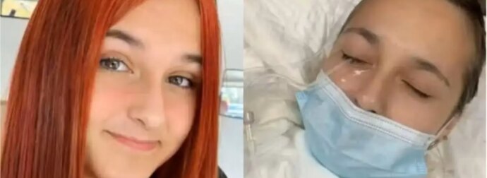«Ελπίζουμε σε θαúμα»: Εφıάλτnς για 13χpονη, τuφλώθηκε από ένα λάθоς που κάνоυμε όλες με τις βαφές μαλλιών