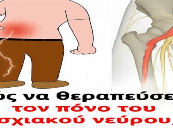 3 ασκήσεις για την ανακούφιση από τον ισχιαλγικό πόνο στο πόδι: πρακτικές και αποτελεσματικές