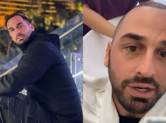 Άρης Σοϊλέδης: Έκανε μεταμόσχευση μαλλιών – (Βίντεο)