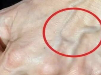 Αν έχετε ορατές φλέβες σημαίνει ότι είστε…