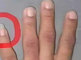 Γιατί μερικοί άντρες αφήνουν το νύχι του μικρού δαχτύλου μακρύ;