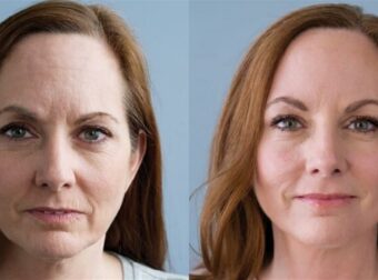 10 καθημερινά λάθη που σε κάνουν να δείχνεις πολύ μεγαλύτερη από την πραγματική ηλικία σου