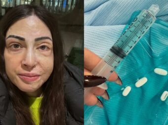 Παλιοσπύρου: Φωτογραφίες & βίντεο από τον δύσκολο αγώνα της αποθεραπείας – «Με ρωτάς πως αντέχω…»