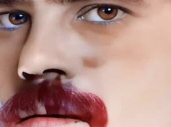 Κάηκε ζωντανός την ώρα που κοιμόταν ο γνωστός Έλληνας ηθοποιός και τραγουδιστής