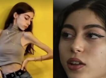 Αυτοψία: Σοκάρει μαρτυρία για τη νευρική ανορεξία στον Σρόιτερ – «Έφτασα 31 κιλά και νόμιζα ότι είμαι χοντρή»