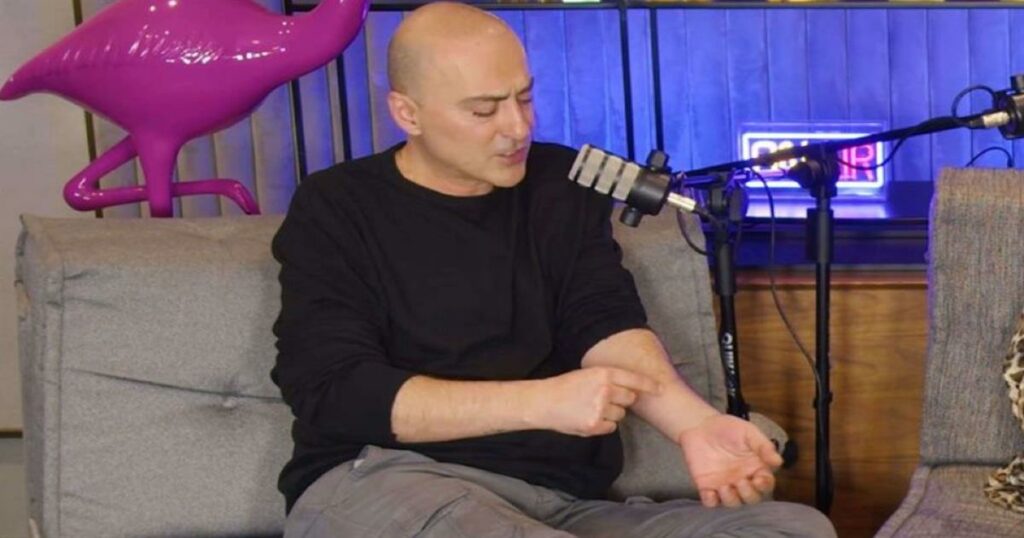 Θανάσης Αλευράς για τη ψωρίαση: «Δεν σταμάτησα ποτέ να την παρατηρώ, έλεγα “εγώ γιατί να το βγάλω;”»