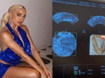 Η Ιωάννα Τούνη το τερμάτισε: Πήρε τους φίλους της στα social ακόμη και στην γυναικολόγο για να αποκαλύψει ότι έχει βάλει σπιράλ