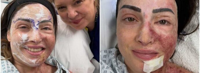 Φωτογραφίες από το νέο πρόσωπο της Ιωάννας Παλιοσπύρου: Η ωμή αλήθεια χωρίς φίλτρα – «Δεν είναι όμορφο. Πονάει. Αλλά χτίζω τον εαυτό μου ξανά»