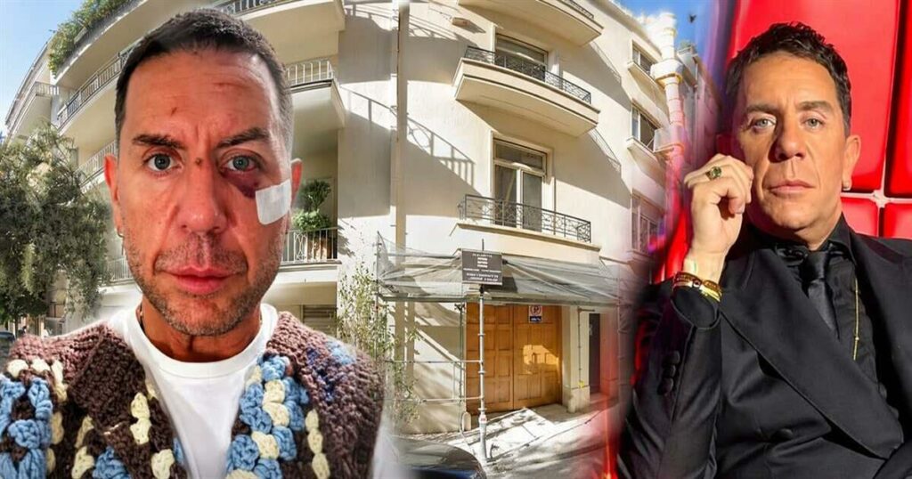 «Σβήνω σώστε με» – Τι είναι η θεραπεία πλασμαφαίρεσης που πήγε να κάνει στο Κολωνάκι ο Γιώργος Μαζωνάκης