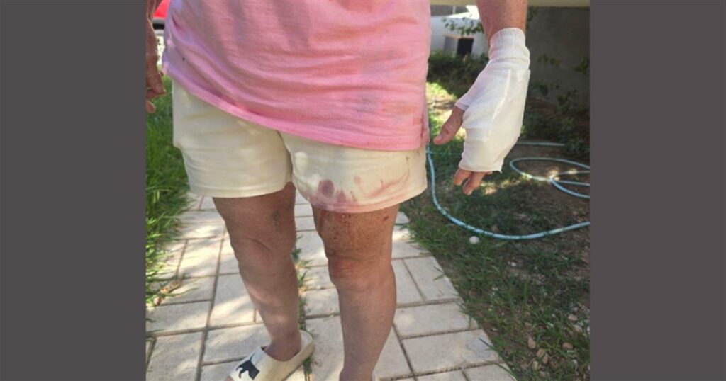 Σκυλιά που φέρονται να ανήκουν σε συγγενικό πρόσωπο του Στέφανου Τσιτσιπά δάγκωσαν 3 άτομα στη Βάρη